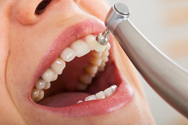 Dental Cleaning Ashburn, VA