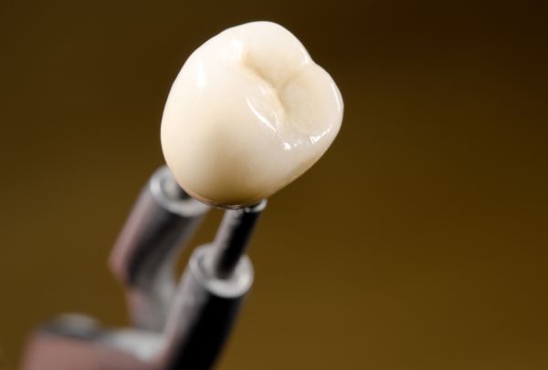 What You Should Know About Different Dental Crown Materials