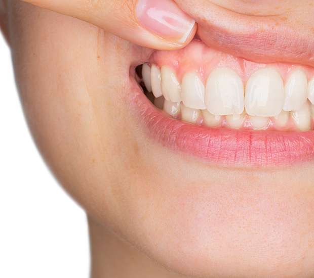 Ashburn Gum Disease