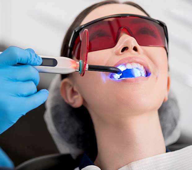 Ashburn Professional Teeth Whitening